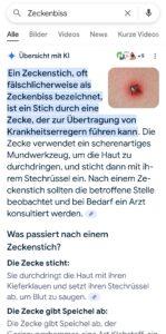 AI Overview Screenshot Zeckenstich Beispiel für Google AI Overviews zum Thema Zeckenstich